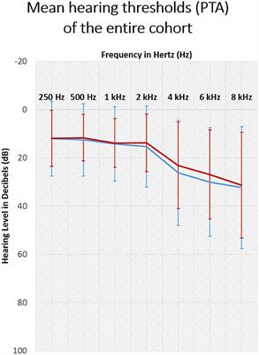 Long-Term Effects of COVID-19 and the Pandemic on Tinnitus Patients